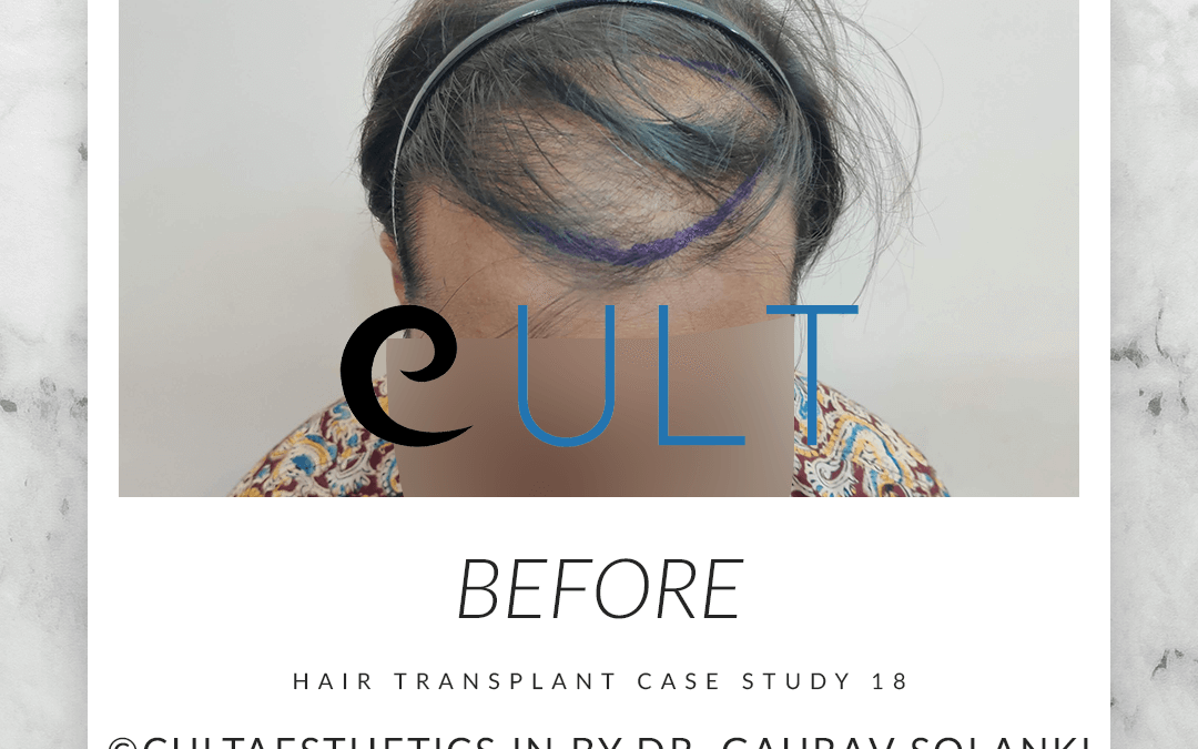 Cult 18 HT Before Final 2