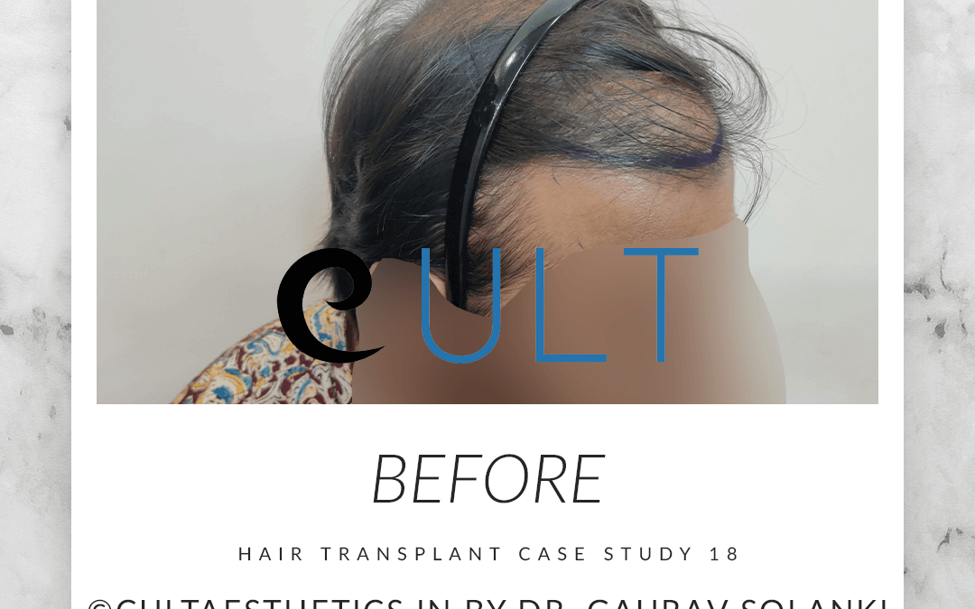 Cult HT Before Final 3