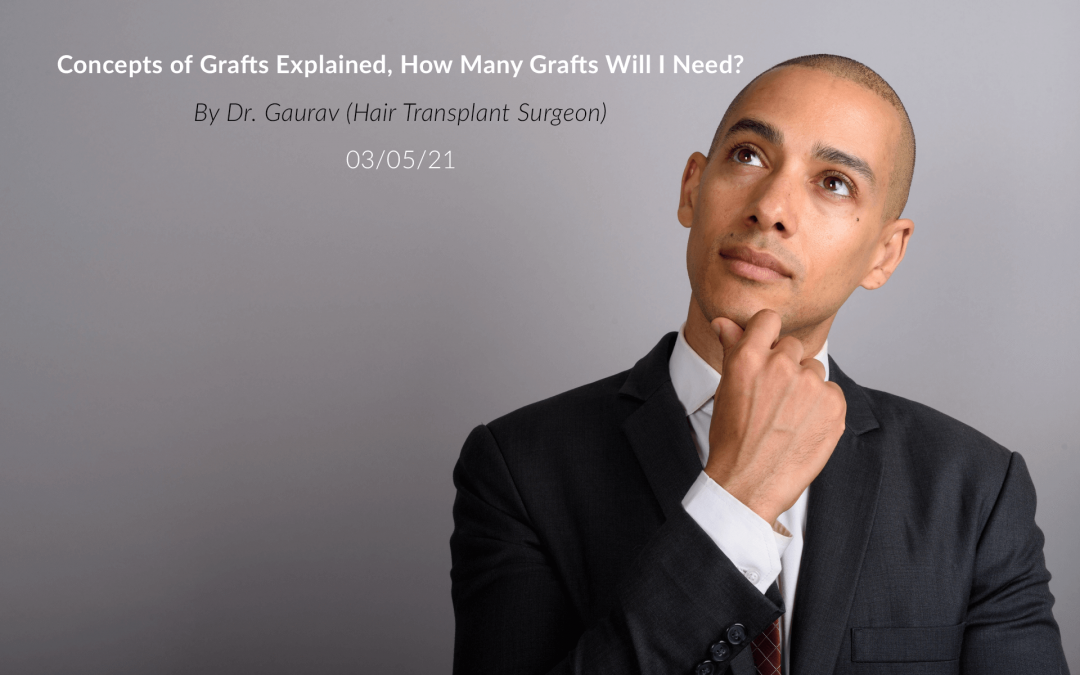 Concepts of Hair Grafts In a Hair Transplant Explained