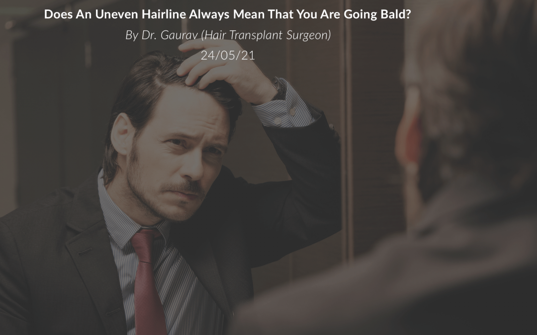 Does An Uneven Hairline Mean That You Balding?