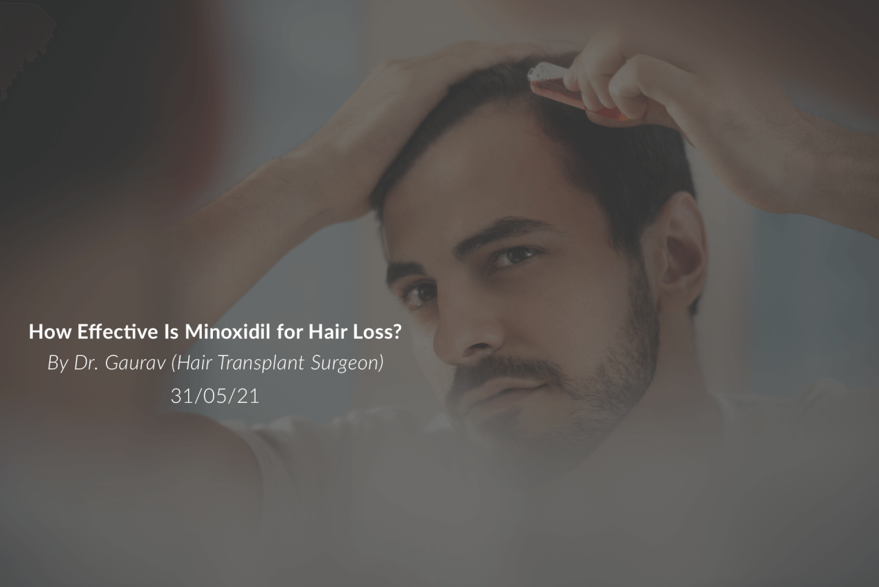 How Effective Is Minoxidil How Effective Is Minoxidil