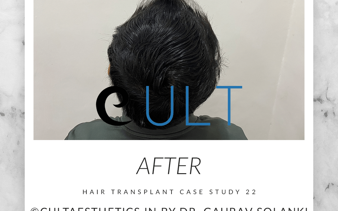 After 5 Example Case Study 22 After-5 | Cult Aesthetics