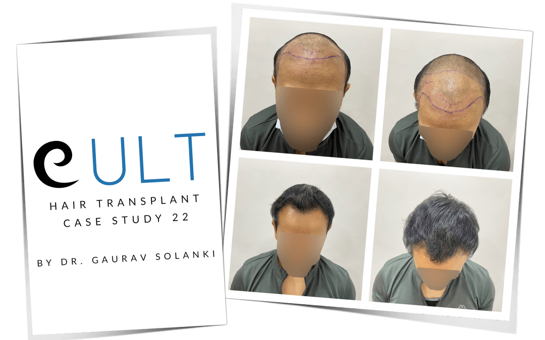 Caset Study 22 Cover