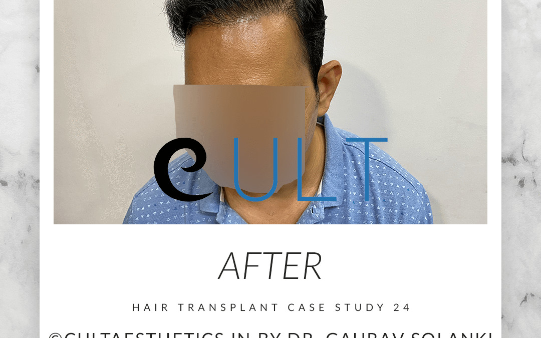Cult Case 24 After 2