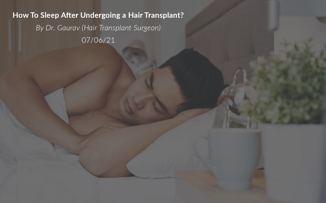 How To Sleep After Undergoing a Hair Transplant?