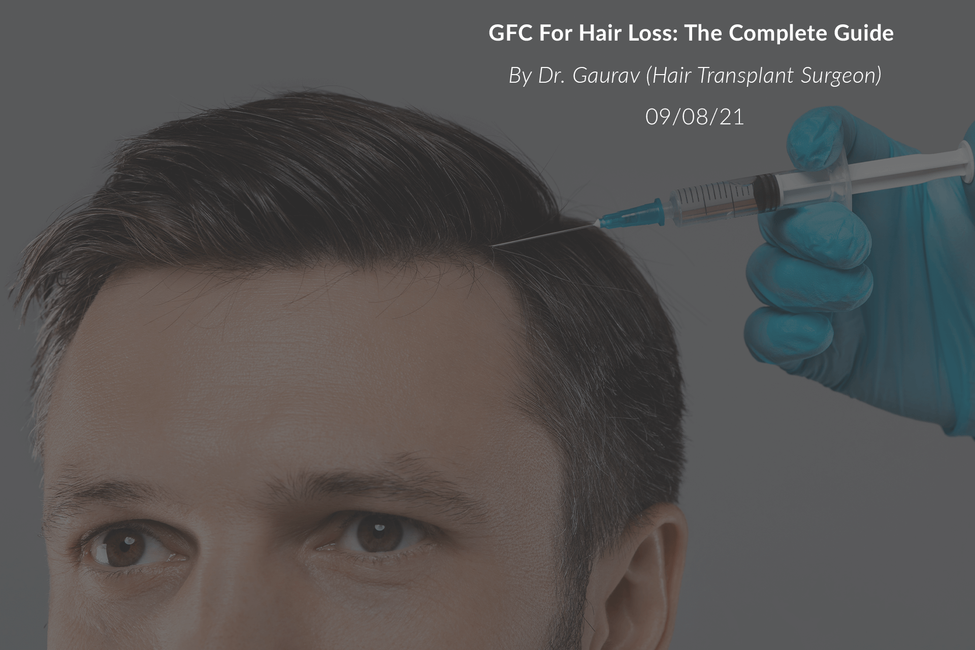 GFC for Hair Loss: The Complete Guide