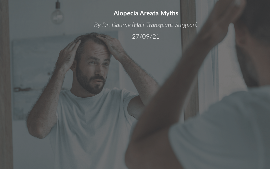 Alopecia Areata Myths