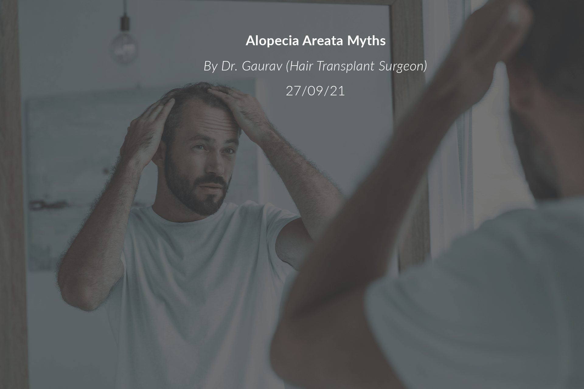 Alopecia Areata Myths