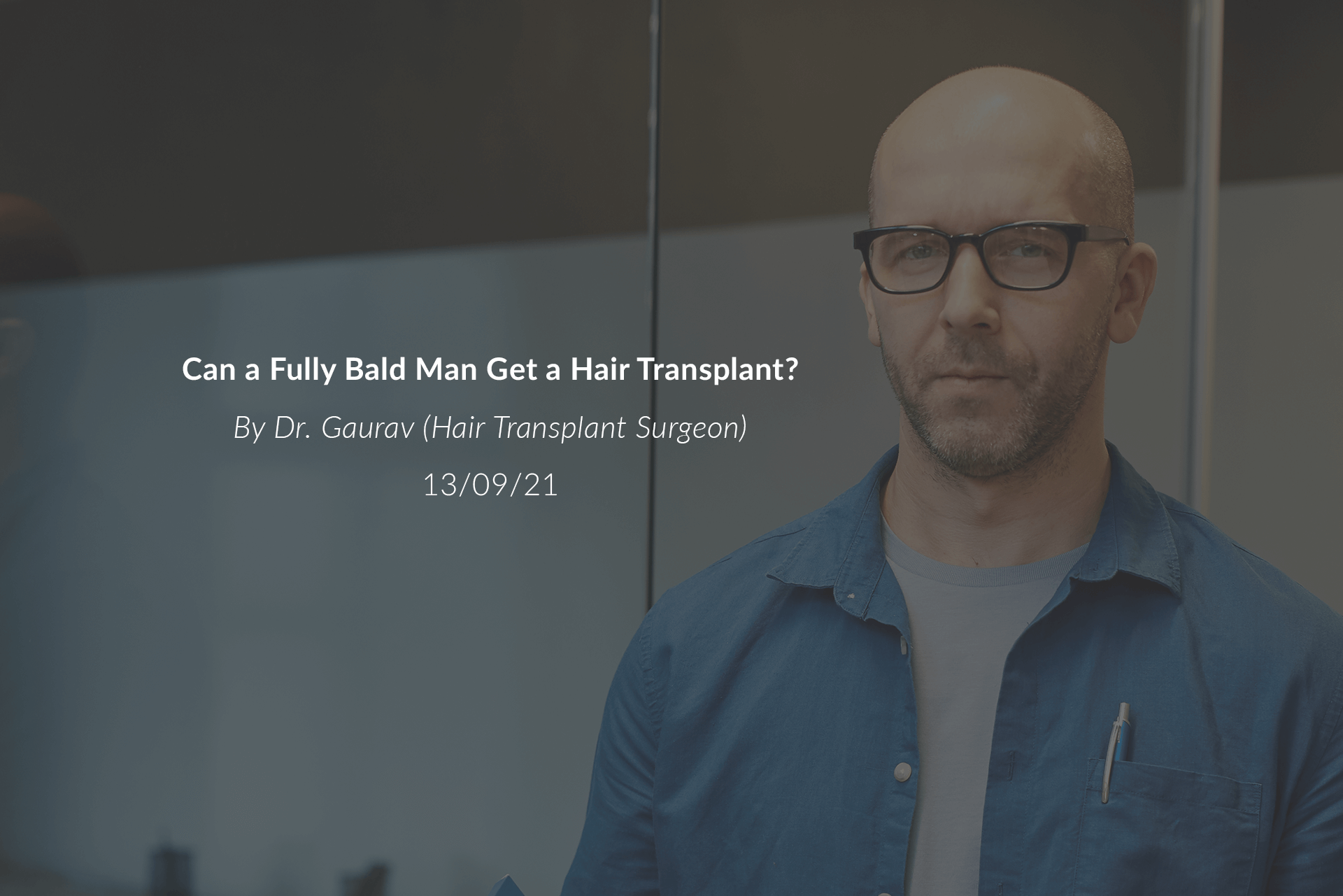 Can a Fully Bald Man Get a Hair Transplant?