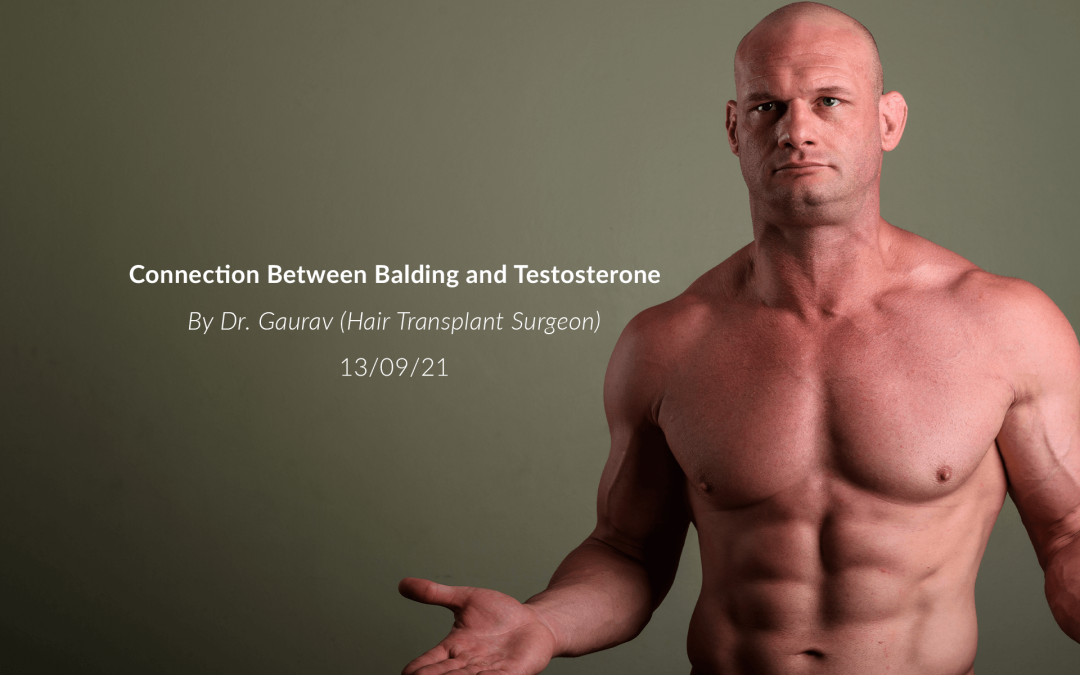 Connection Between Balding & Testosterone