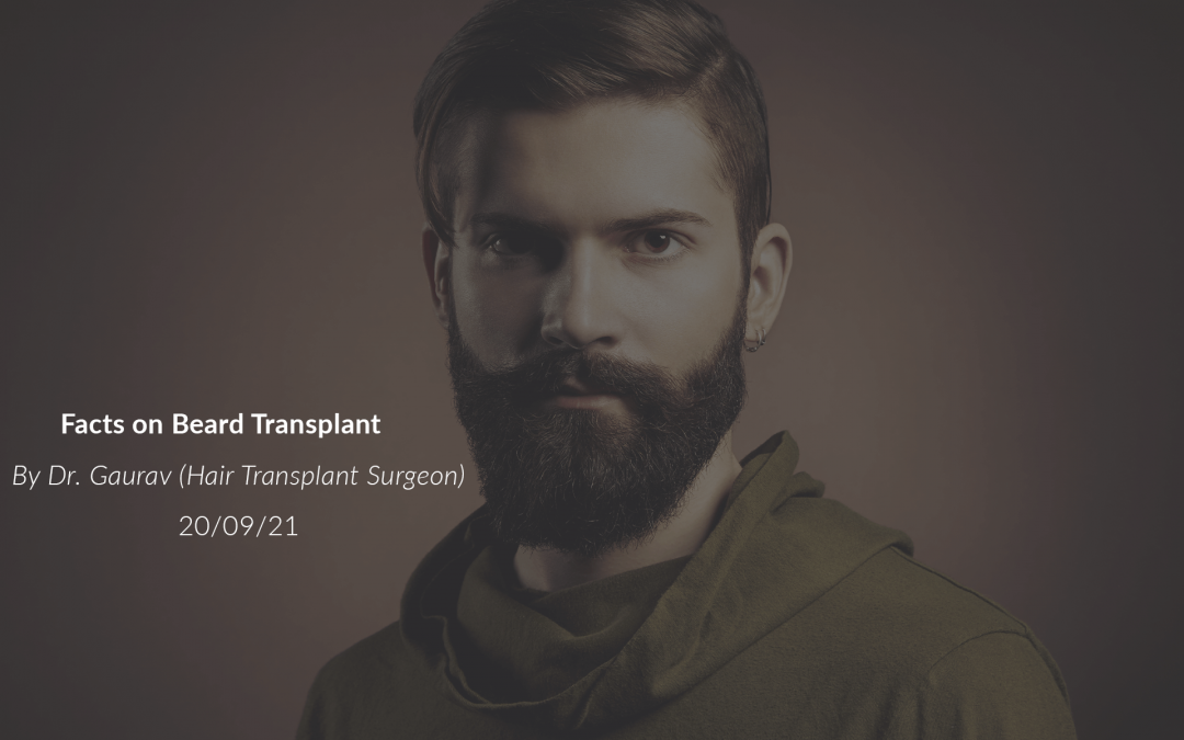 Facts on Beard Transplant