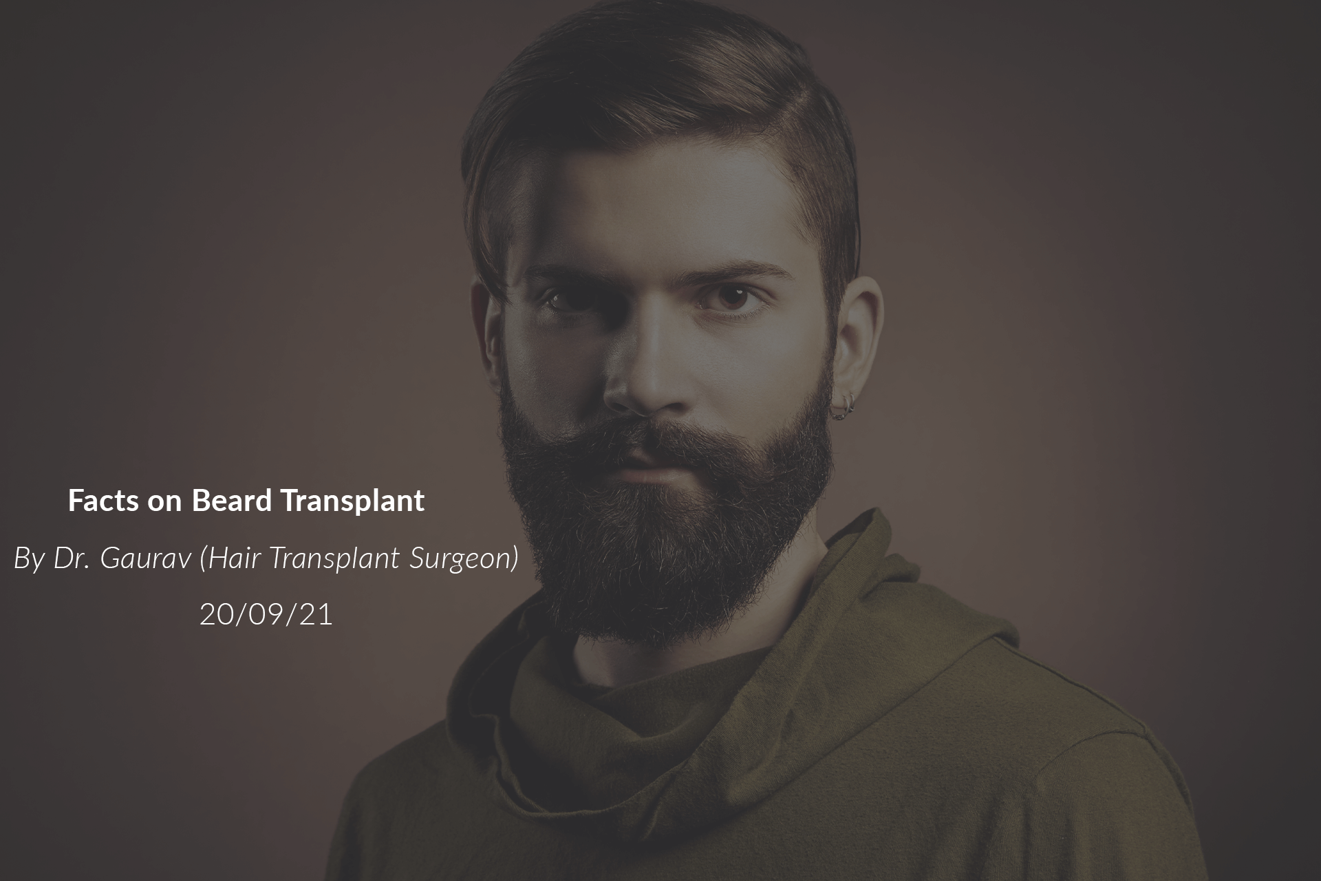 Facts on Beard Transplant