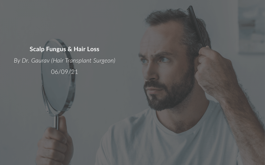 Scalp Fungus & Hair Loss