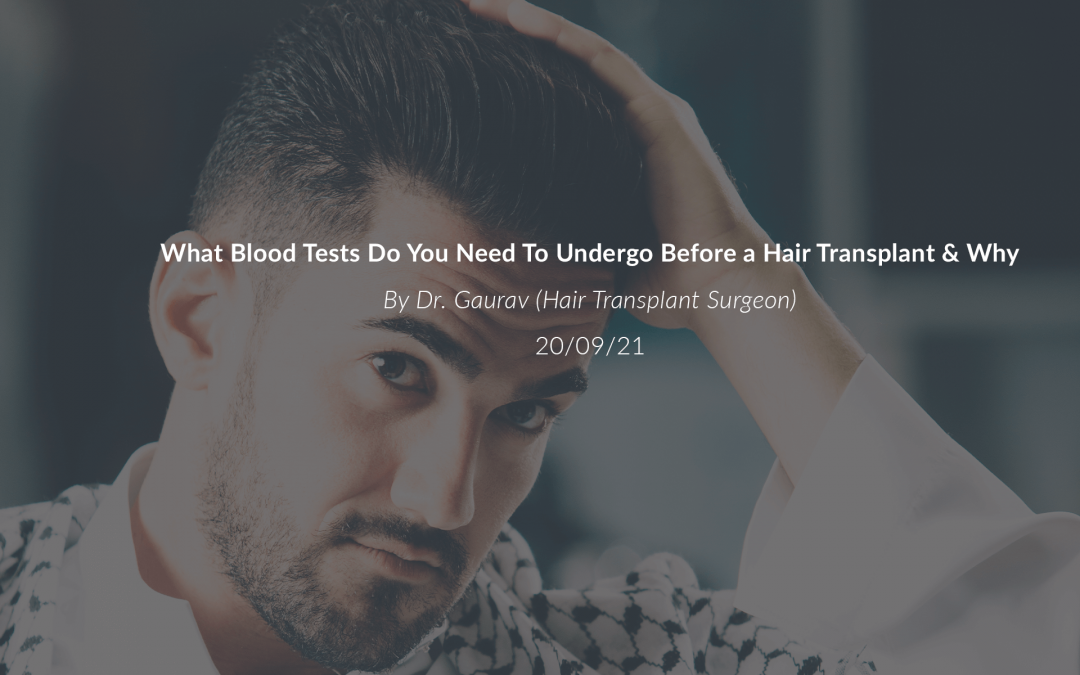 What Blood Tests Do You Need To Undergo Before a Hair Transplant & Why?