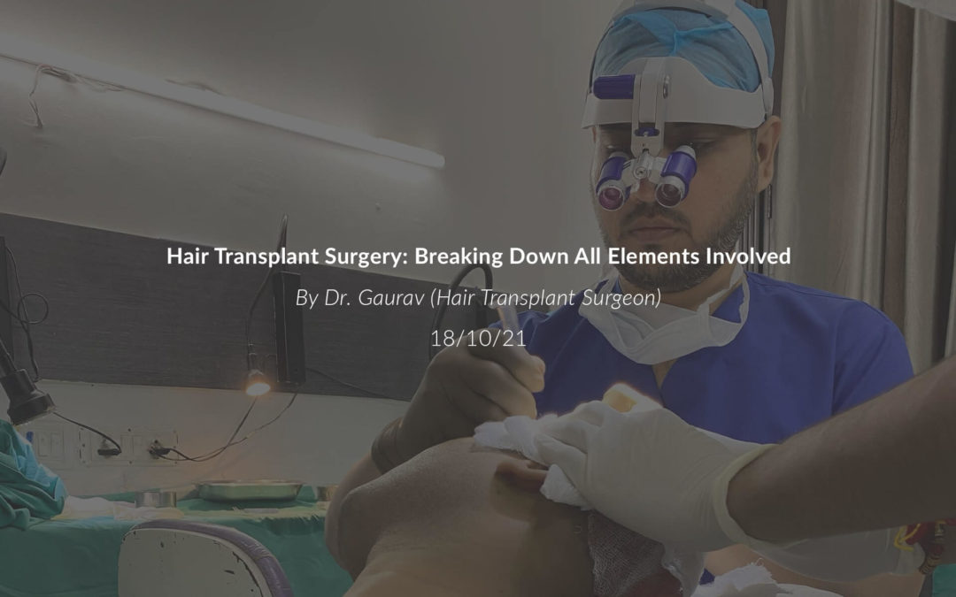 Hair Transplant Surgery: Breaking Down All Elements Involved