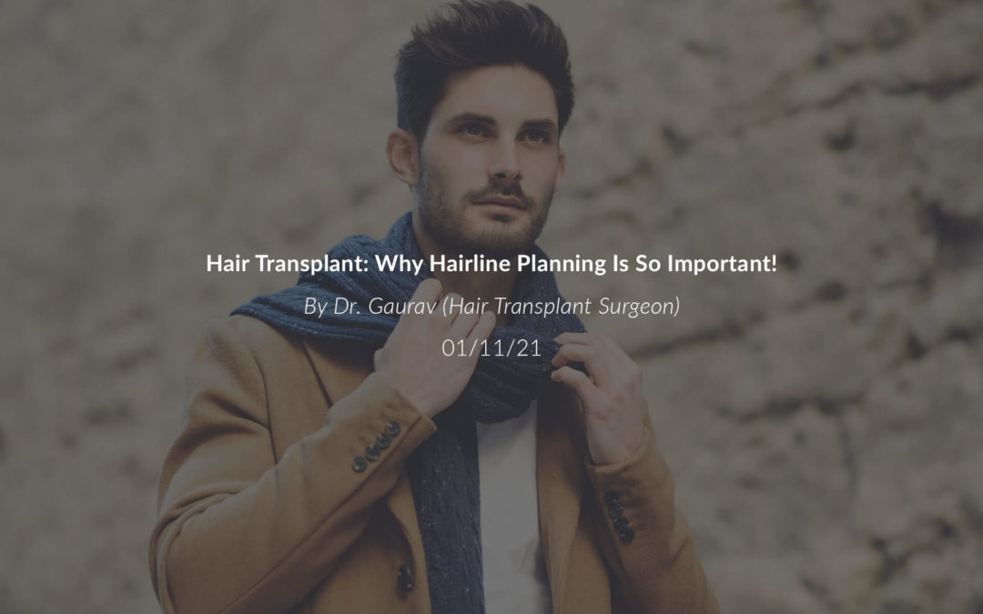 Hair Transplant: Why Hairline Planning Is So Important!