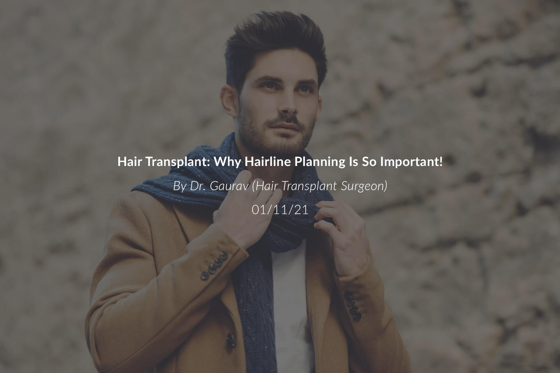 Hair Transplant Why Hairline Planning Is So Important!