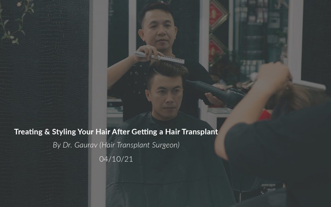 Treating & Styling Your Hair After Getting a Hair Transplant