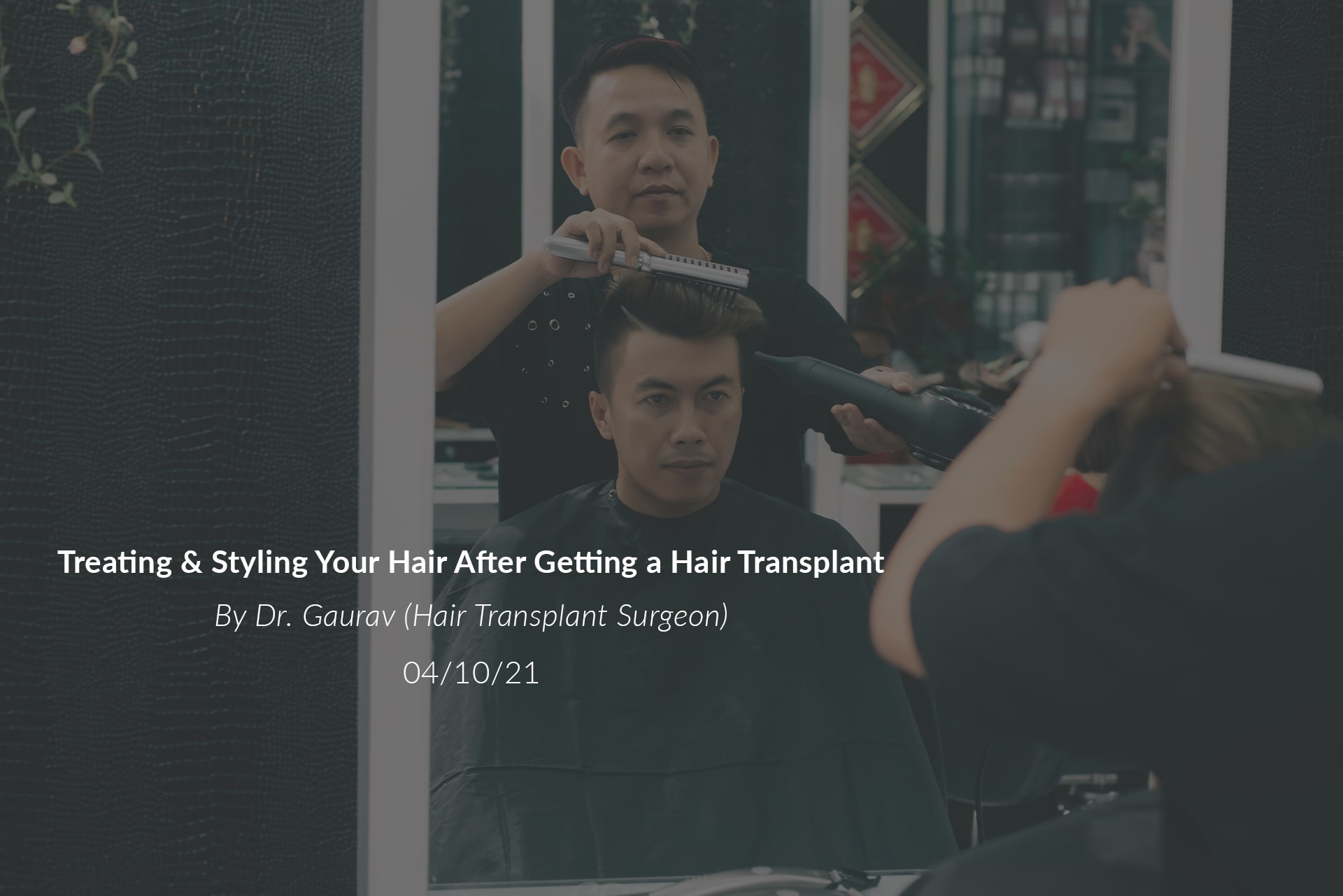 Treating & Styling Your Hair After Getting a Hair Transplant