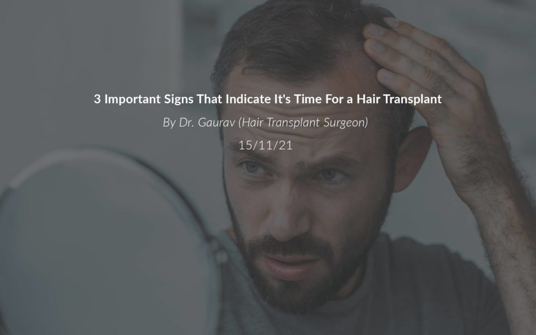 3 Important Signs That Indicate It Is Time for a Hair Transplant