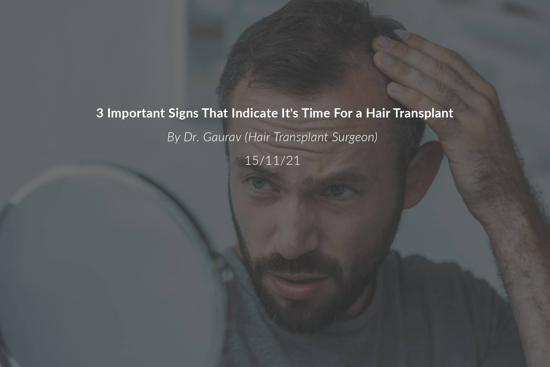 3 Important Signs That Indicate It's Time For a Hair Transplant