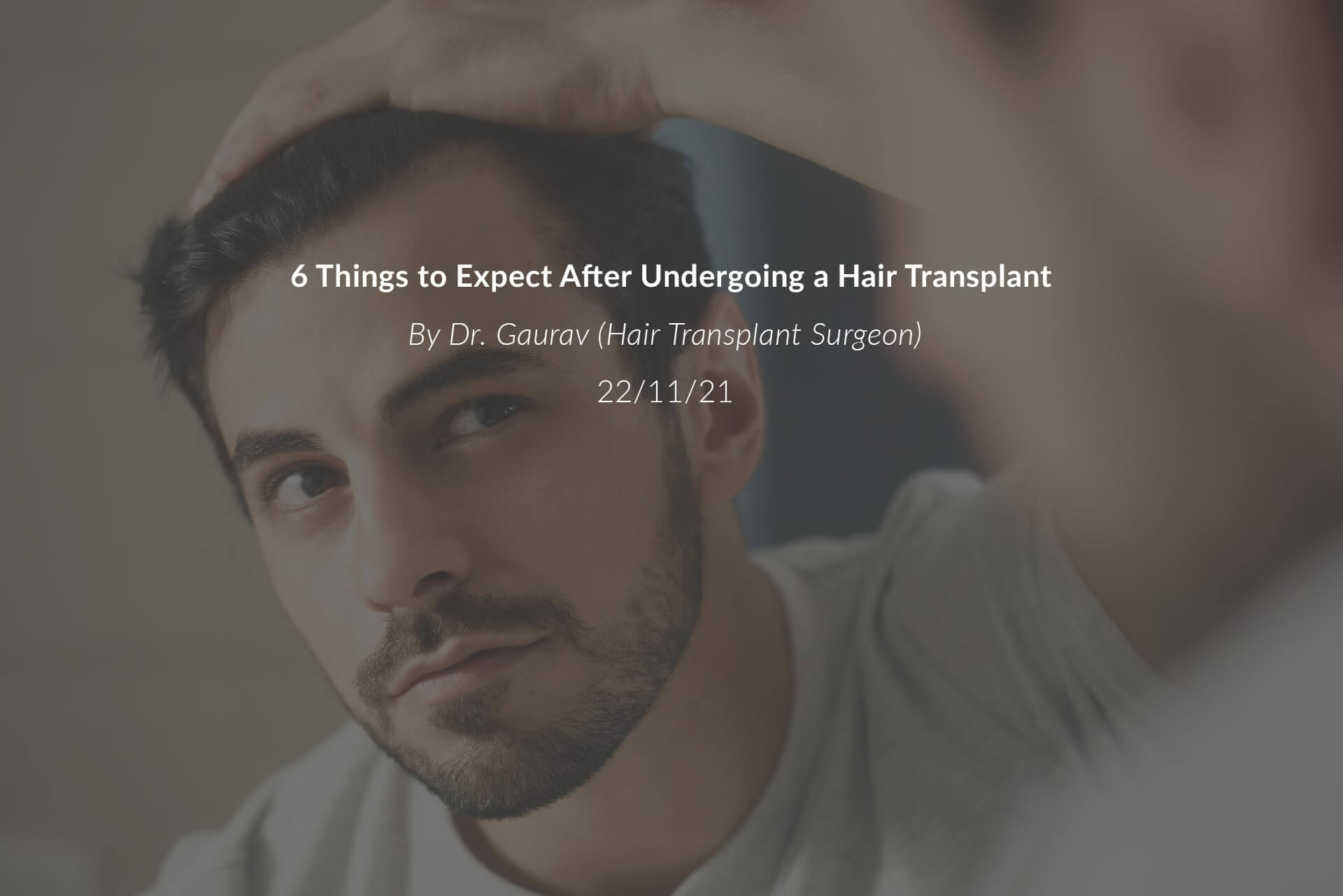 6 Things to Expect After Undergoing a Hair Transplant