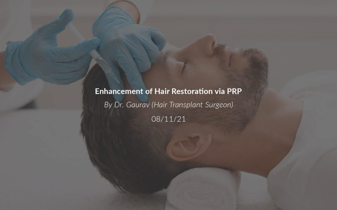 Enhancement of Hair Restoration via PRP