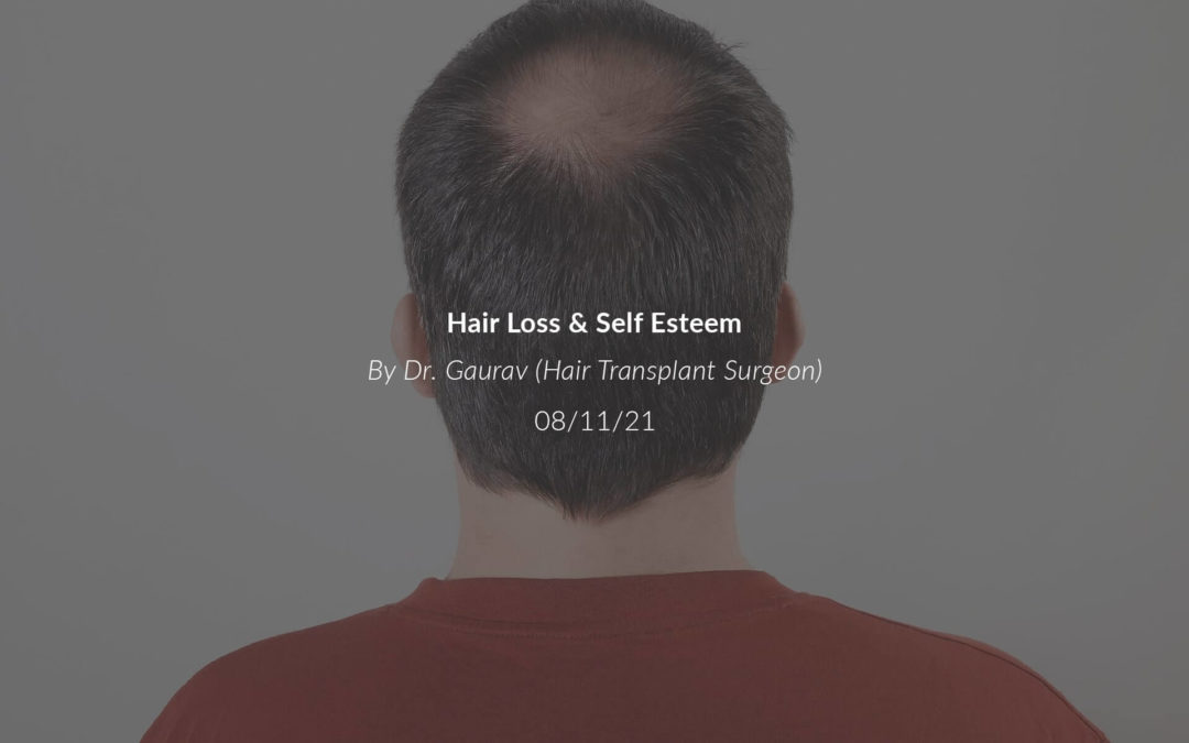 Hair Loss & Self Esteem