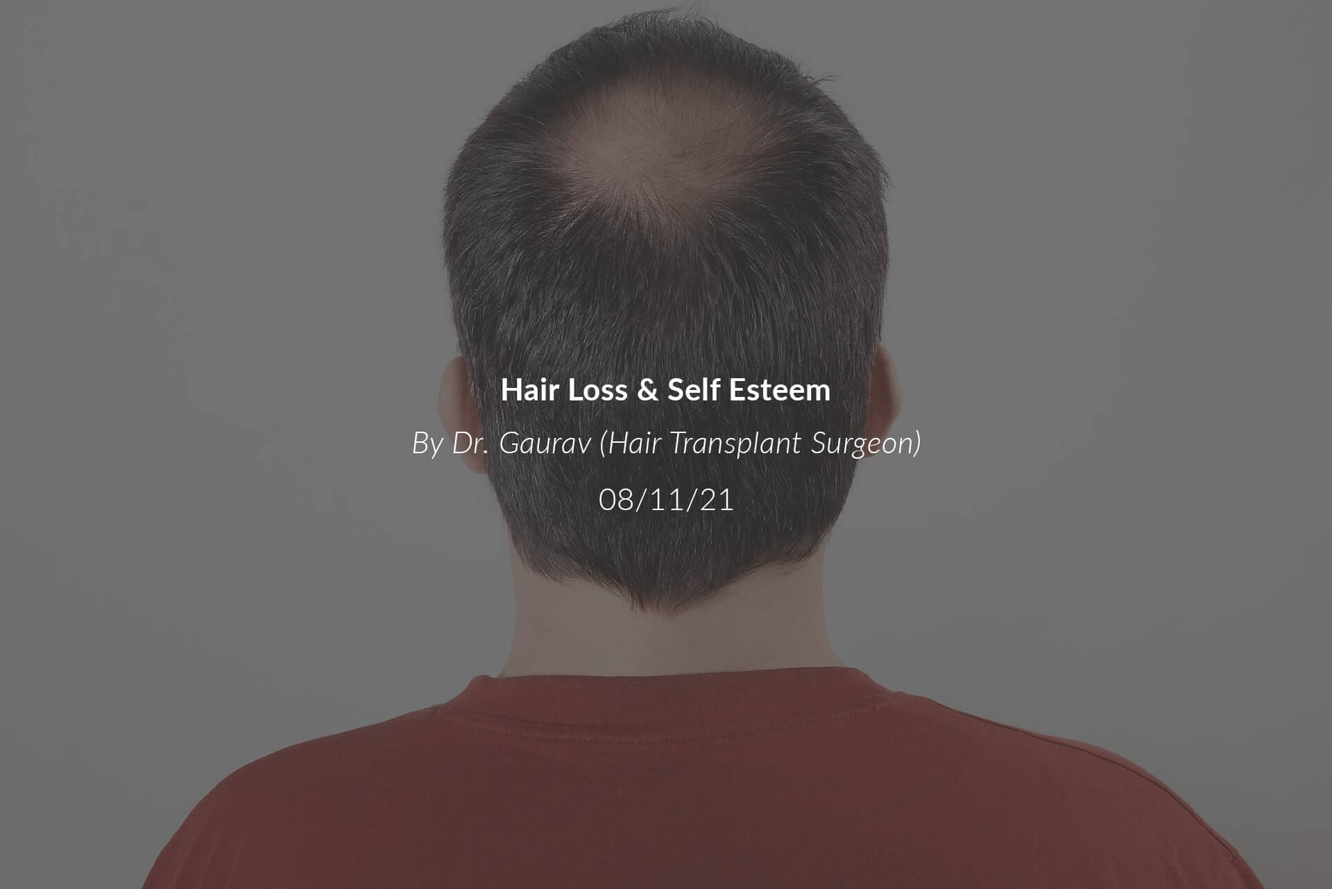 Hair Loss and Self Esteem