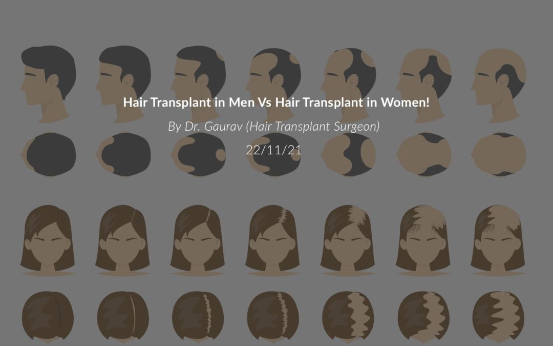 Hair Transplant in Men Vs Hair Transplant in Women!