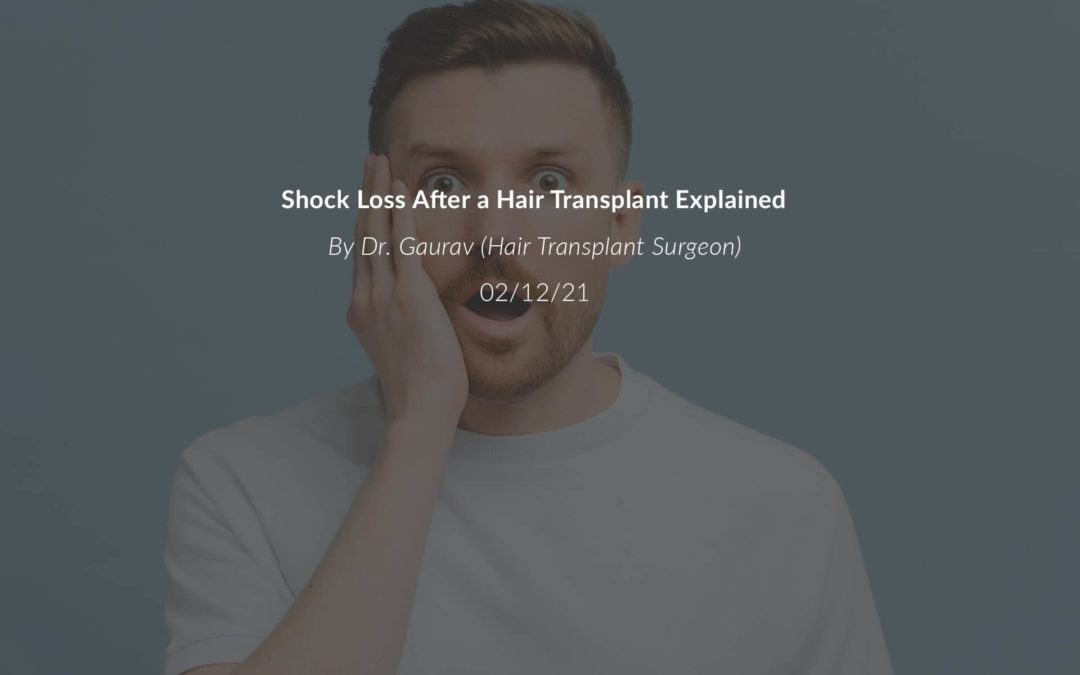 Shock Loss After a Hair Transplant Explained