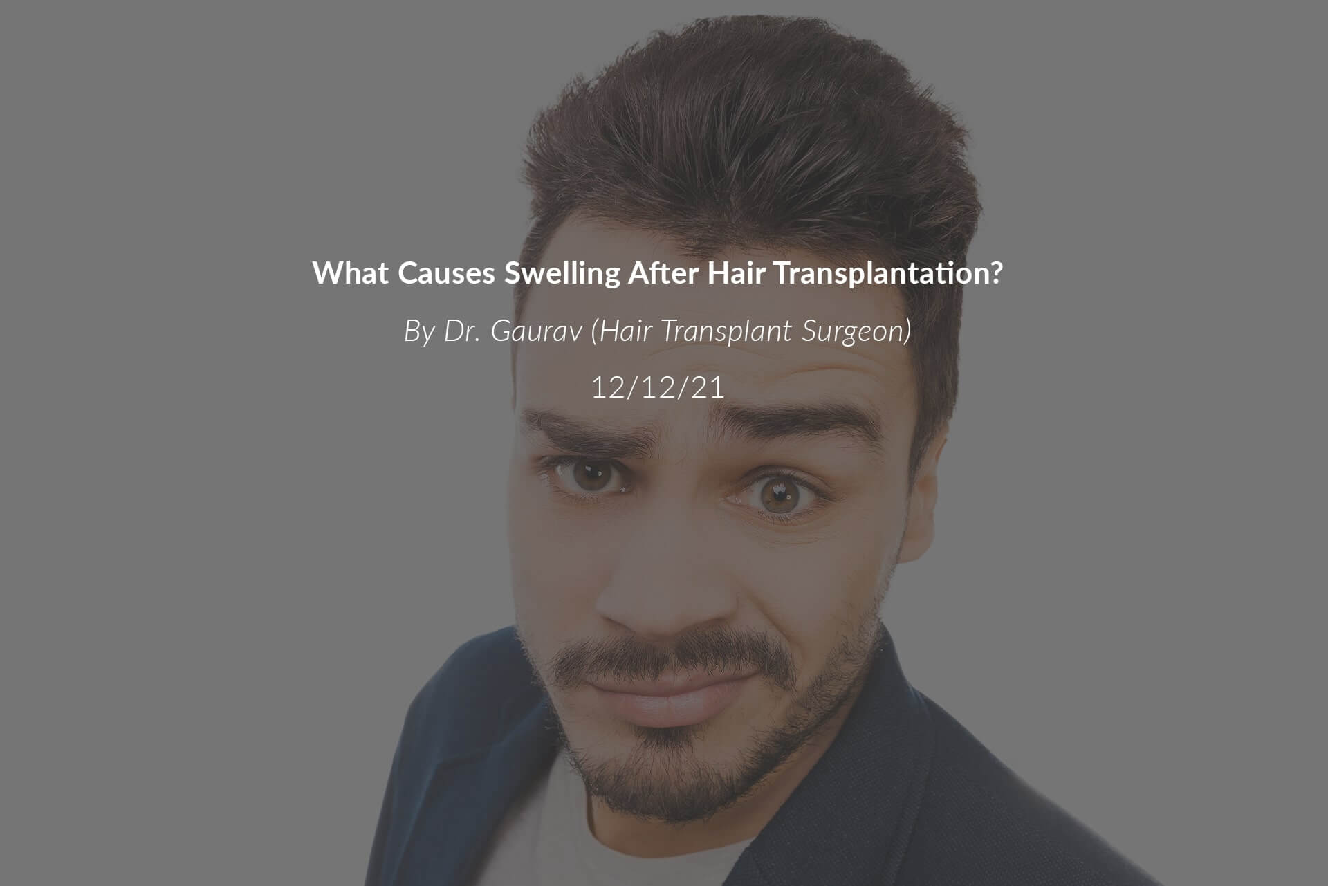 What Causes Swelling After Hair Transplantation?