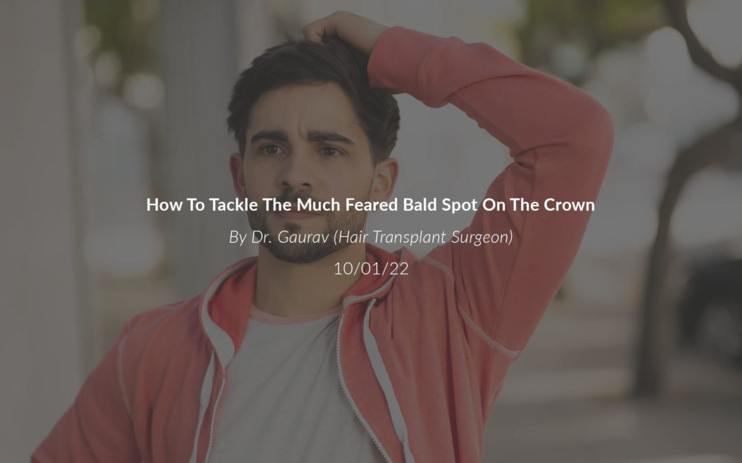 How To Tackle the Much Feared Bald Spot On The Crown?