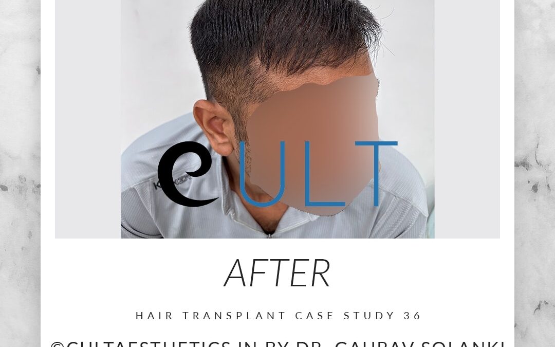 Long Term Update Case 36 3