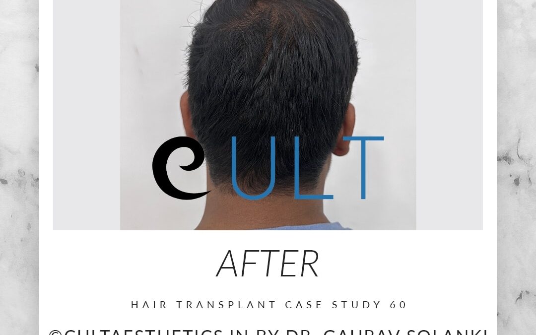 Long Term Update Case 60 2