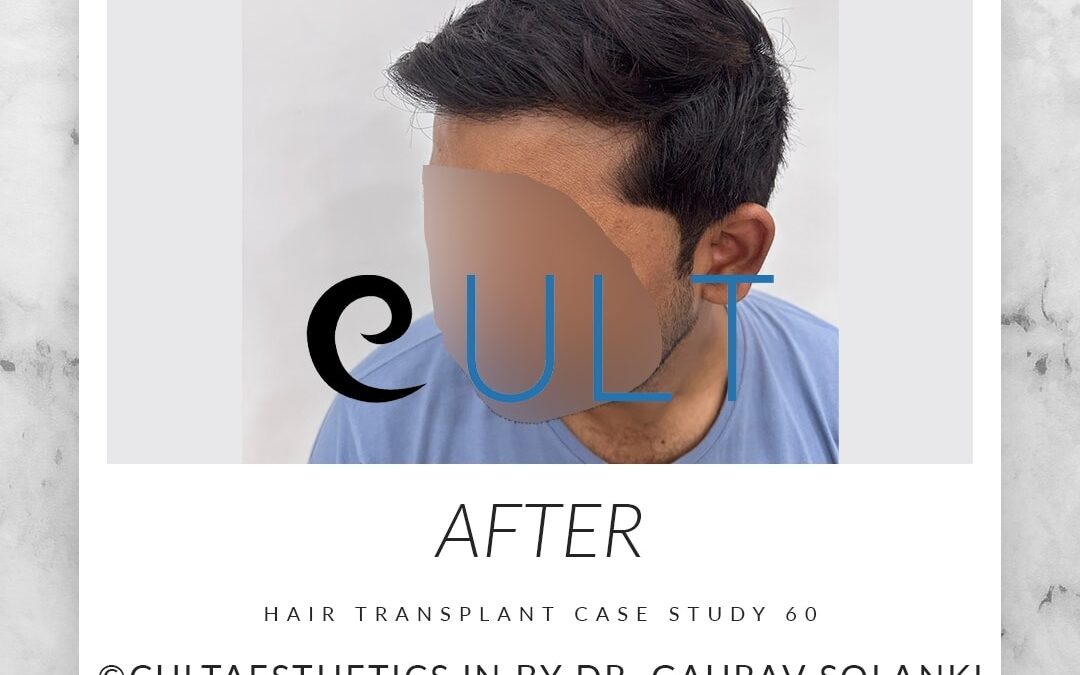 Long Term Update Case 60 4