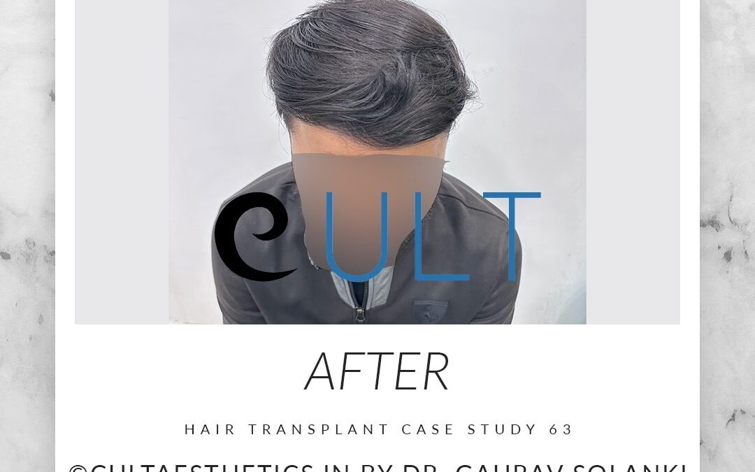 Long Term Update Case 63 3