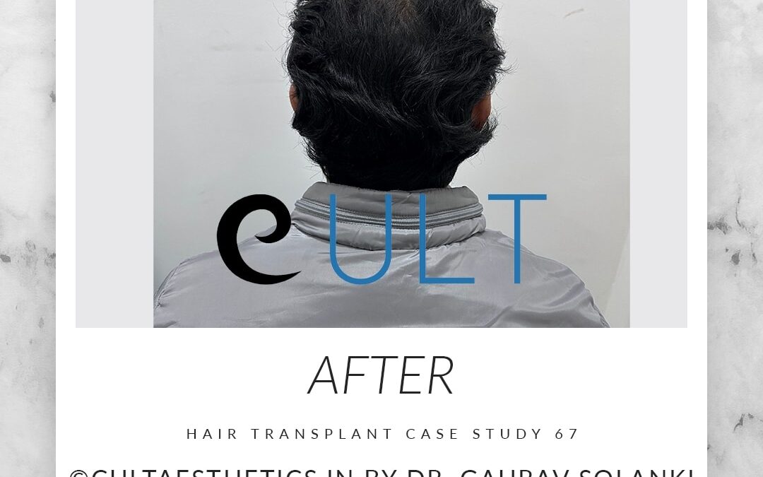 Long Term Update Case 67 2