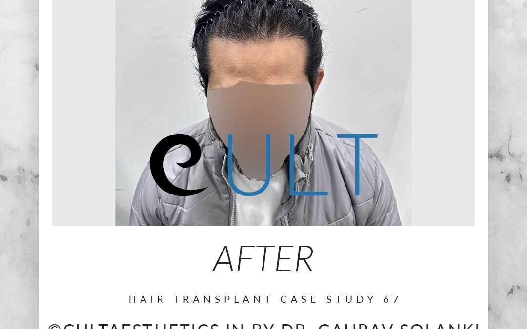 Long Term Update Case 67 4