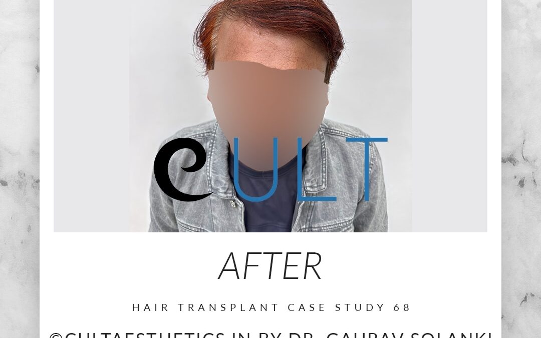 Long Term Update Case 68 6