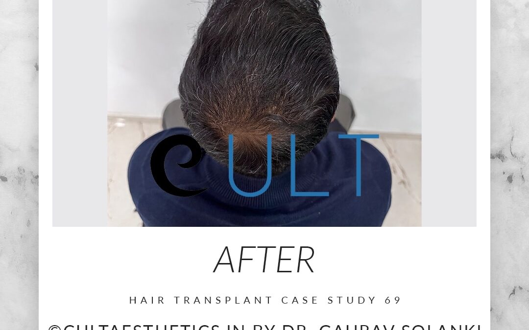 Long Term Update Case 69 1