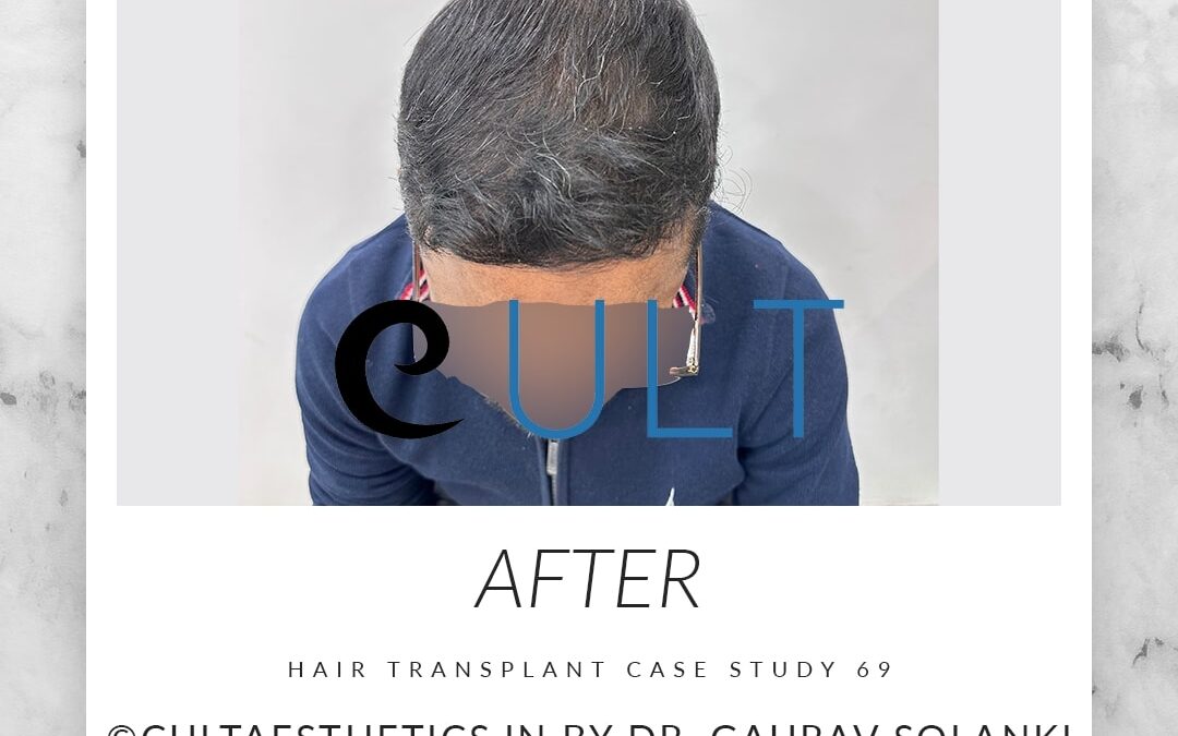 Long Term Update Case 69 3