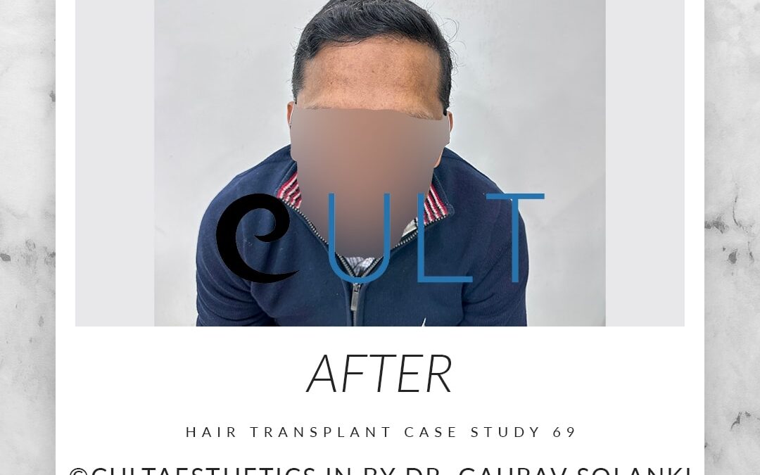 Long Term Update Case 69 4