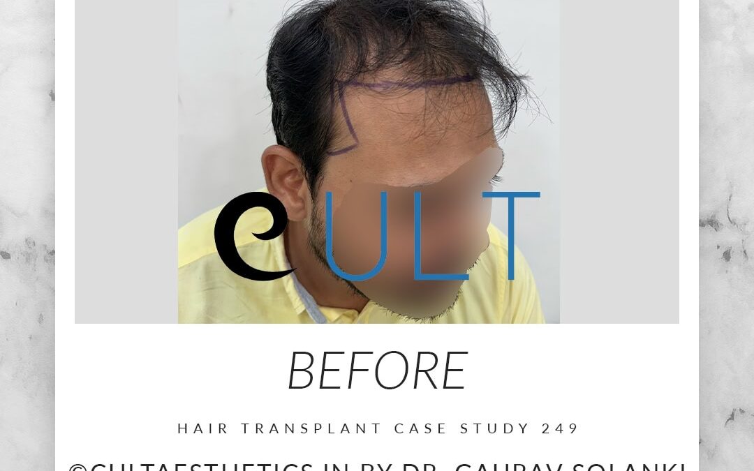 Case 249 Before 4