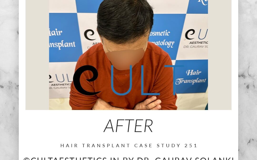 Case 251 After 3