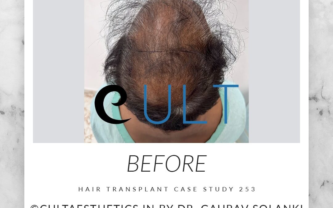 Case 253 Before 4