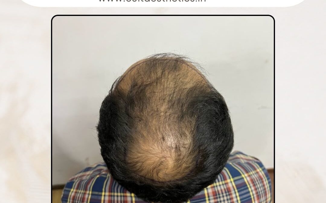 Hair Case 273 Before 4