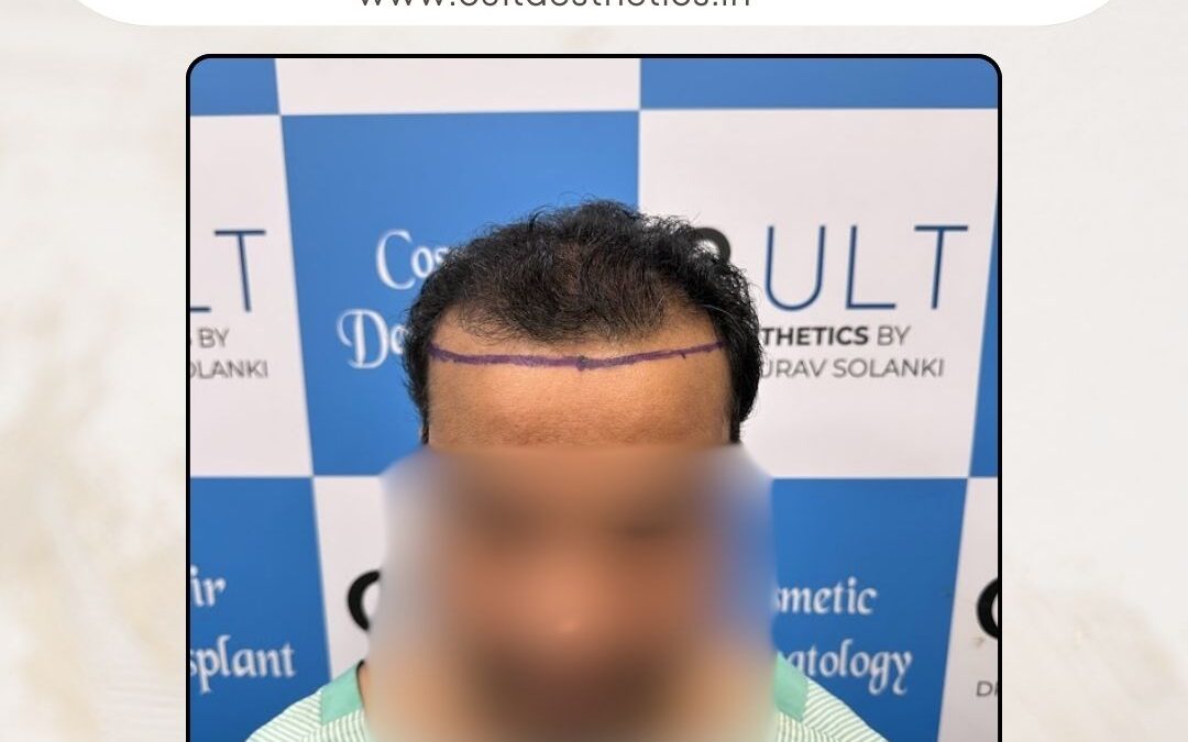 Hair Case 290 Before 1