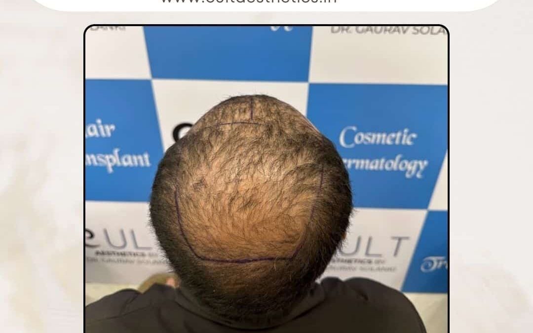 Hair Case 283 Before 4