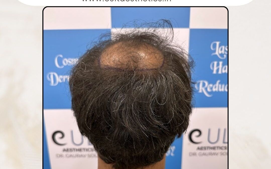 Hair Case 307 Before 4